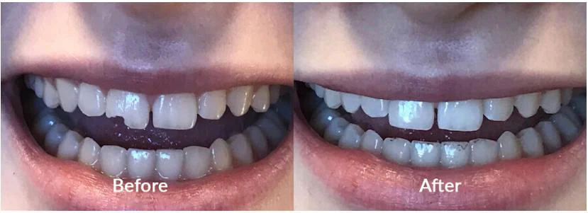 Advanced Emerald Dentistry- Puyallup Picture 8