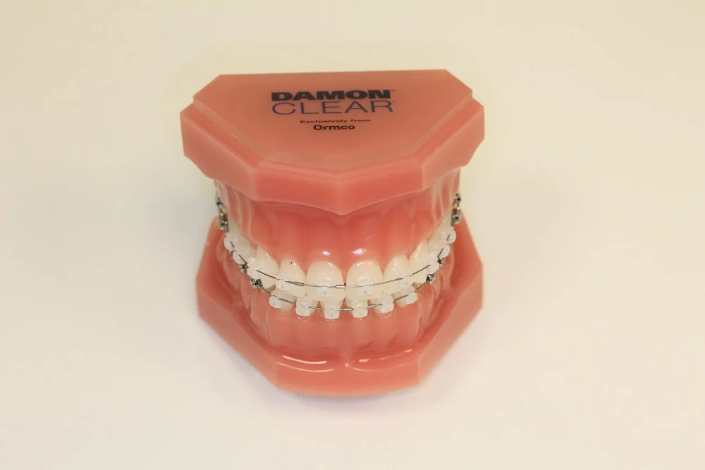 Nordberg Orthodontics Picture 8