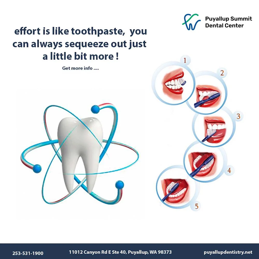 Puyallup Summit Dental Center Picture 10