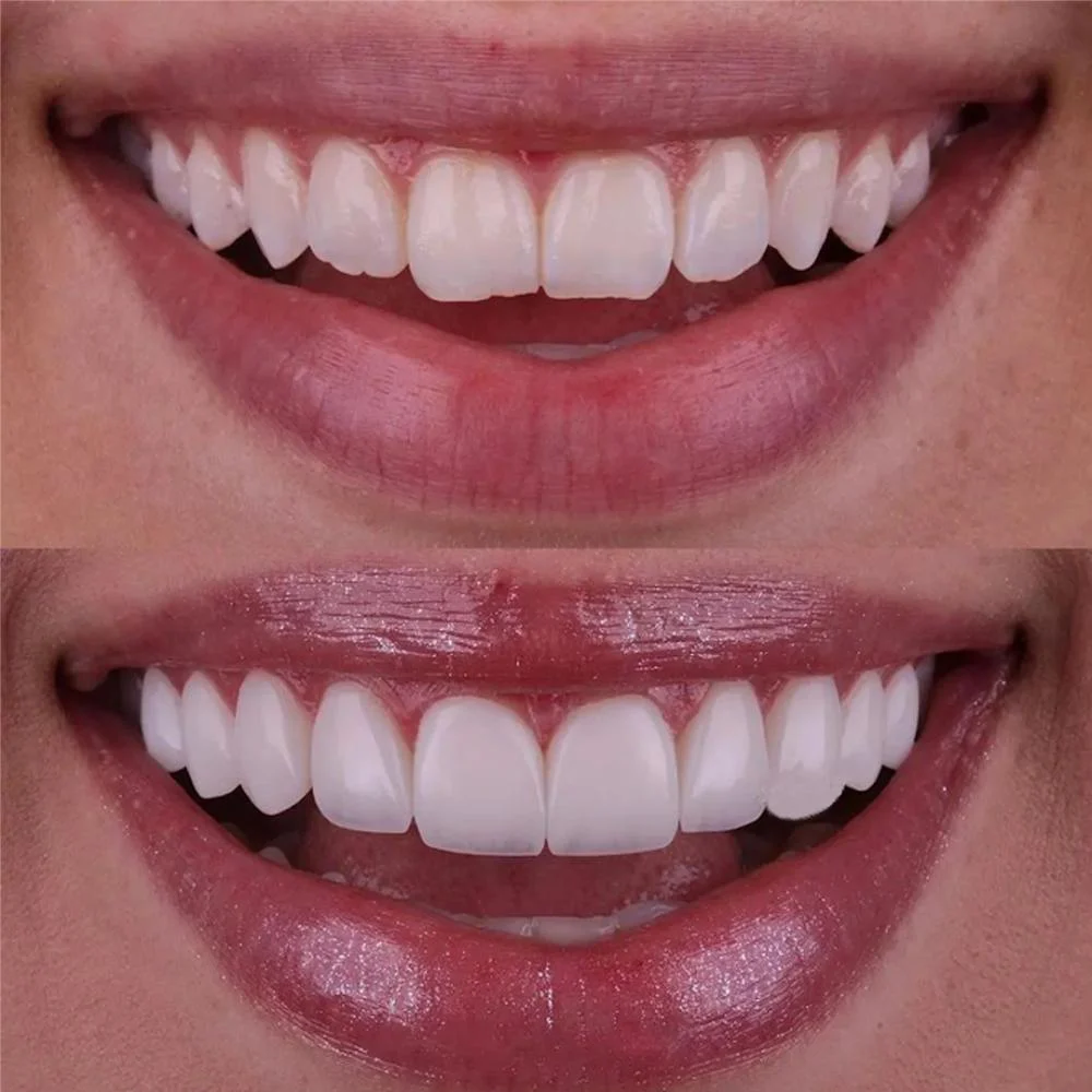 Puyallup Summit Dental Center Picture 6