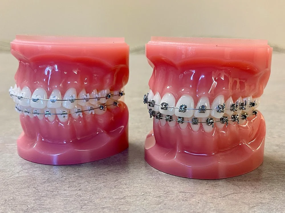 Proctor Braces Picture 4