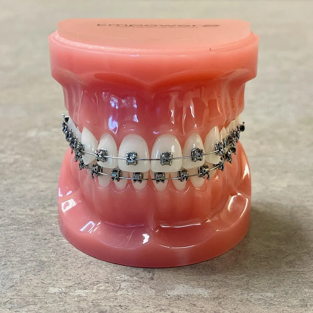 Proctor Braces Picture 6