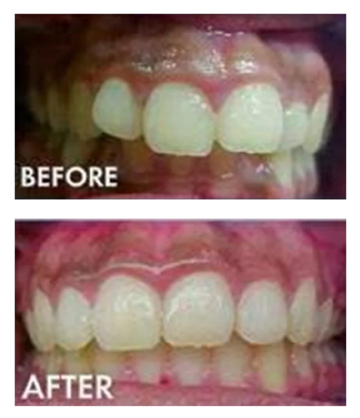 Cool Smiles Orthodontics - Colton Picture 10