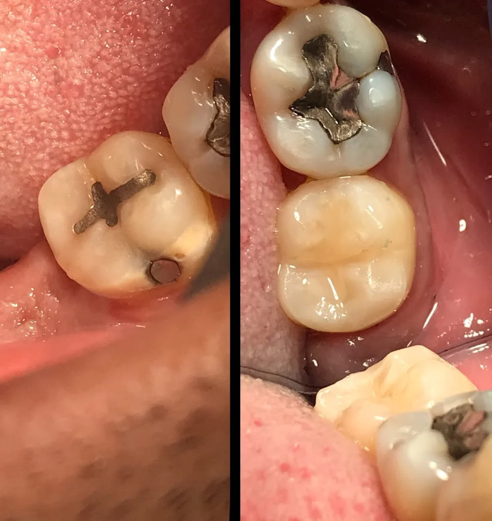 Melody Dental Care Picture 4
