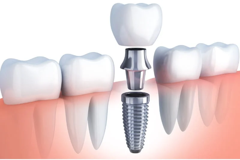 Abbey Dental, Inc. Picture 1
