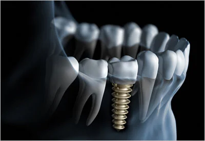 Abbey Dental, Inc. Picture 4