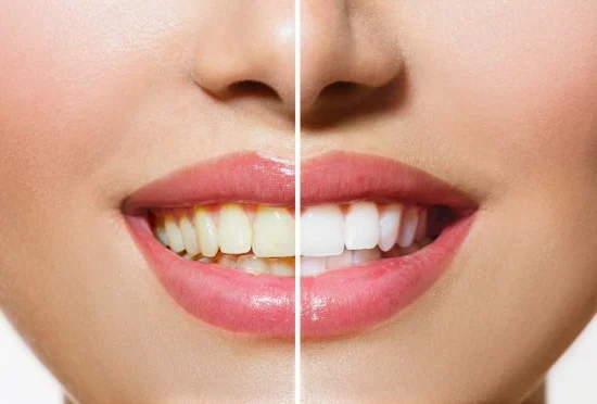 Victoria Village Dentistry: Dentist - Implant - Extraction Picture 6