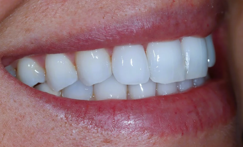 Chroma Dentistry Practice of Dr. Sylvia Carlos Picture 1