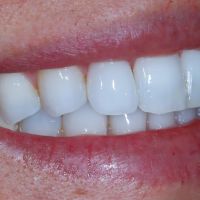 Chroma Dentistry Practice of Dr. Sylvia Carlos ico