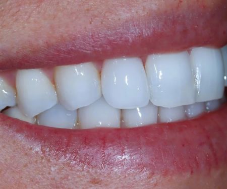 Chroma Dentistry Practice of Dr. Sylvia Carlos