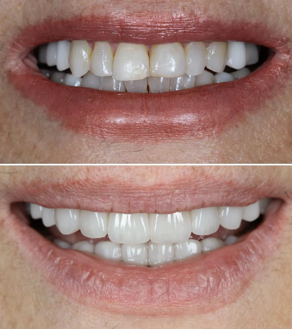 SoCal Prime Dentistry Picture 6