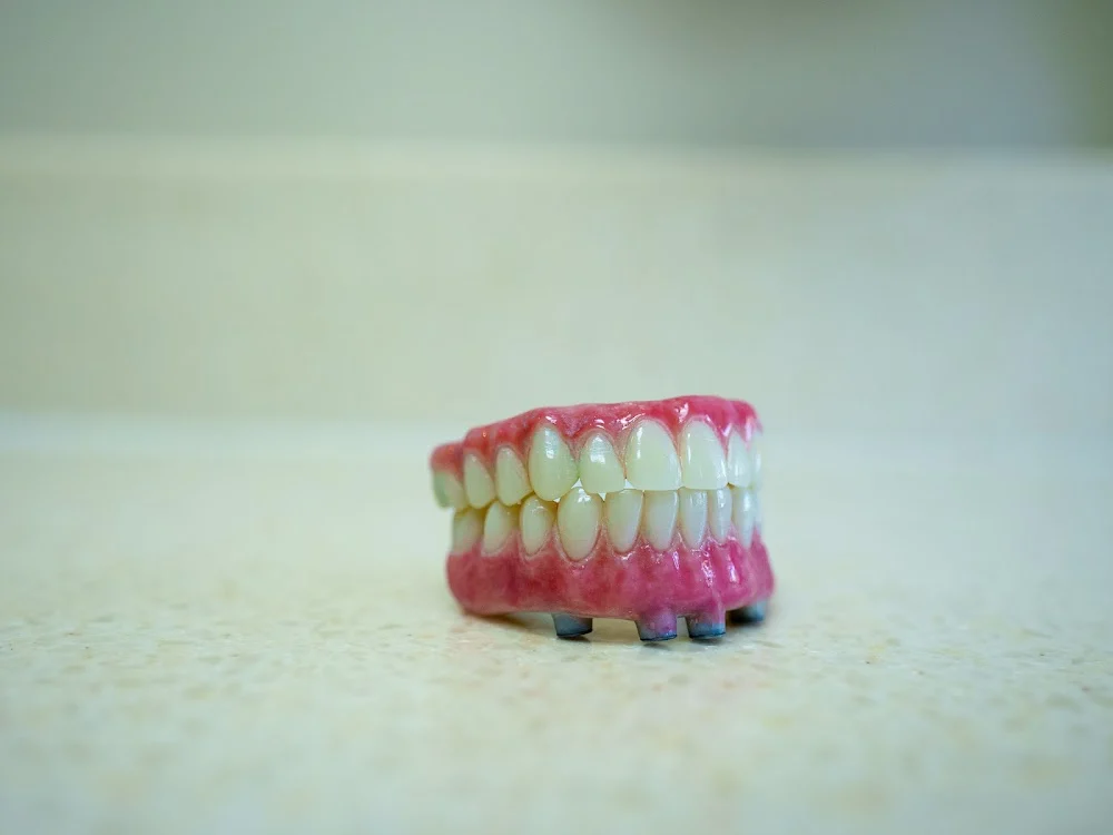 Same Day Smile Designs Picture 3