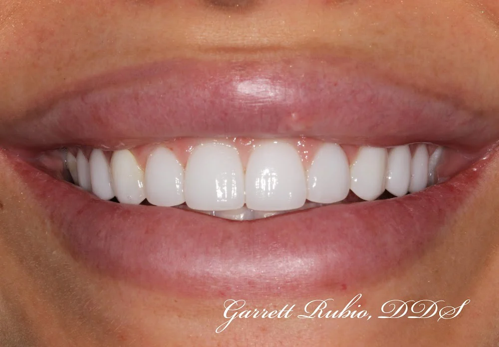Garrett Rubio, DDS Picture 7