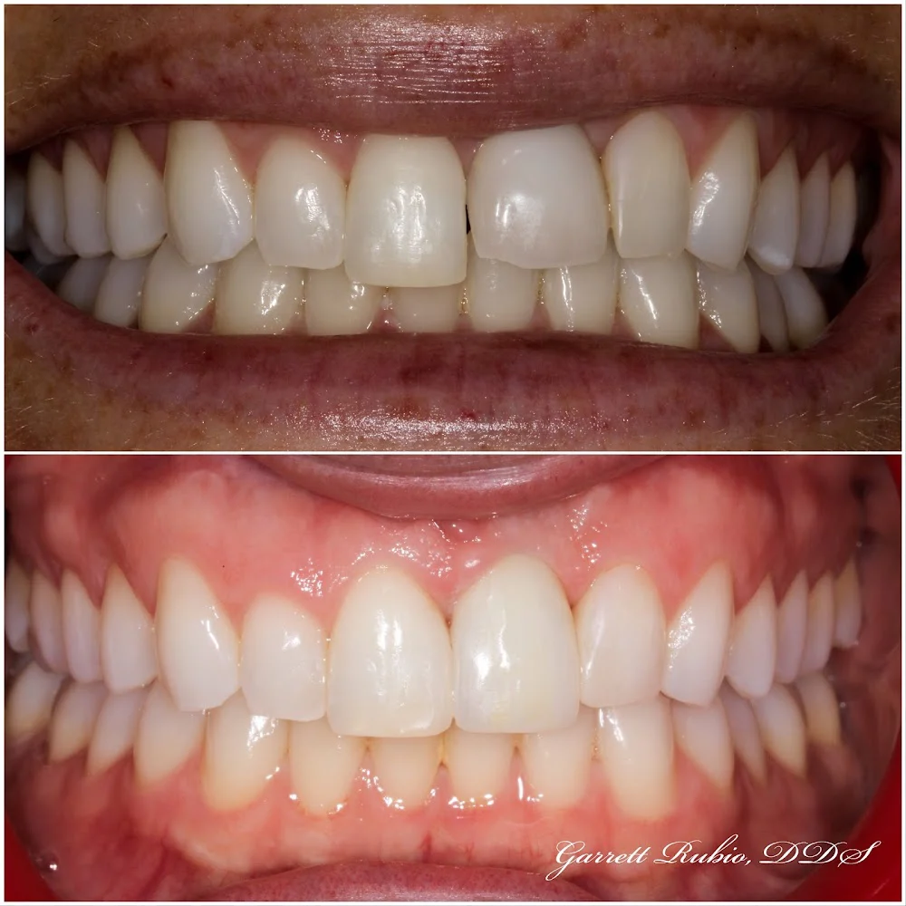 Garrett Rubio, DDS Picture 2