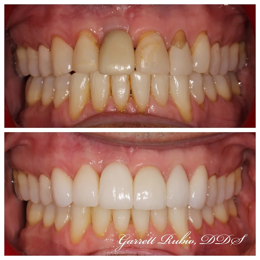Garrett Rubio, DDS Picture 9