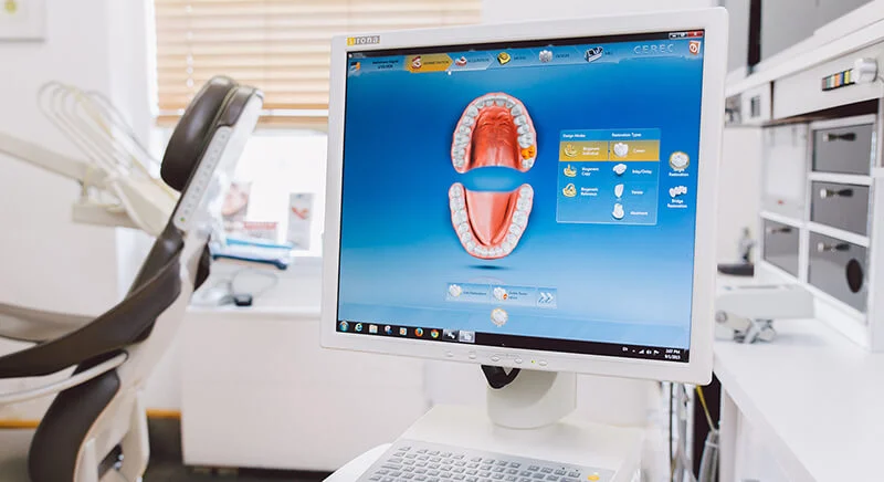 Dental Crown in an Hour: Naples Picture 1