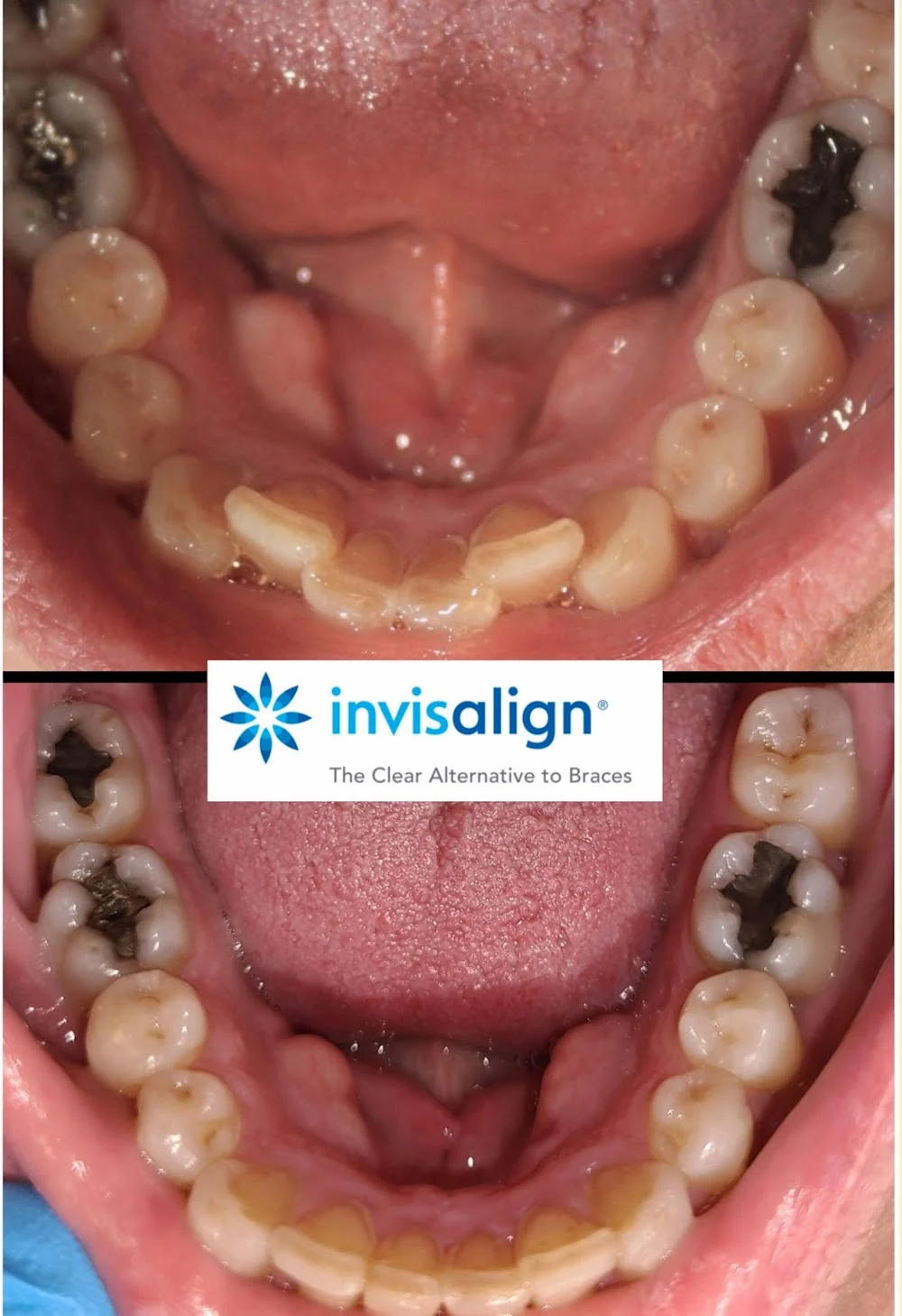 Aesthetic Dentistry at Bayfront Picture 2