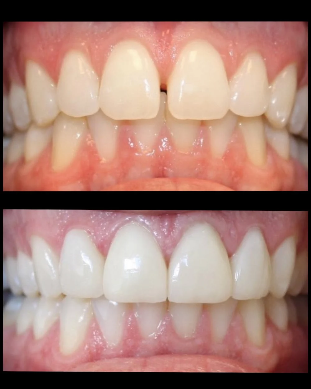 Aesthetic Dentistry at Bayfront Picture 3
