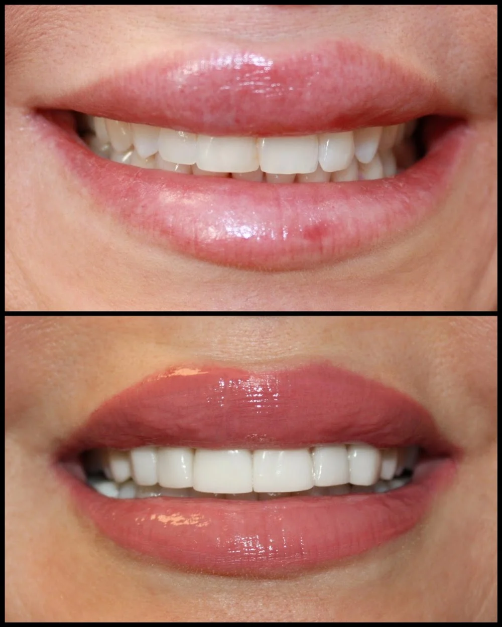 Aesthetic Dentistry at Bayfront Picture 4