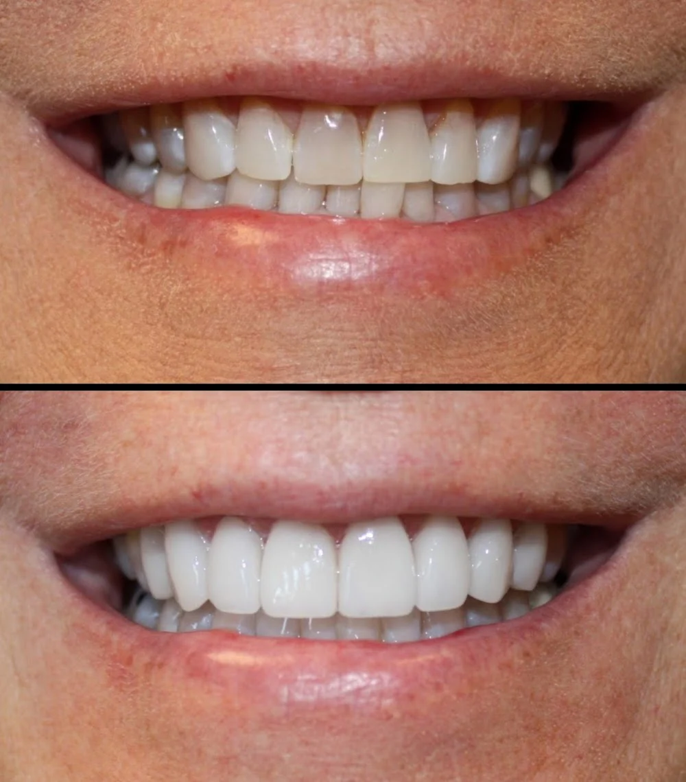 Aesthetic Dentistry at Bayfront Picture 1
