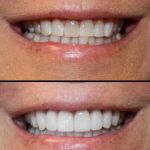 Aesthetic Dentistry at Bayfront