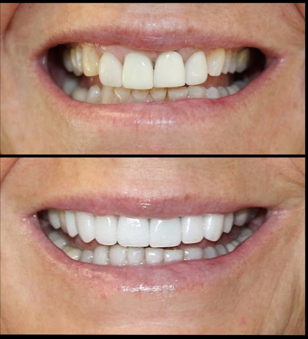 Aesthetic Dentistry at Bayfront Picture 10