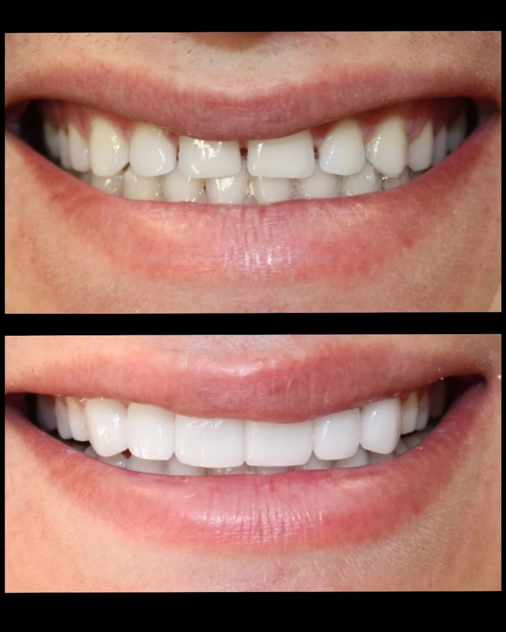 Aesthetic Dentistry at Bayfront Picture 9