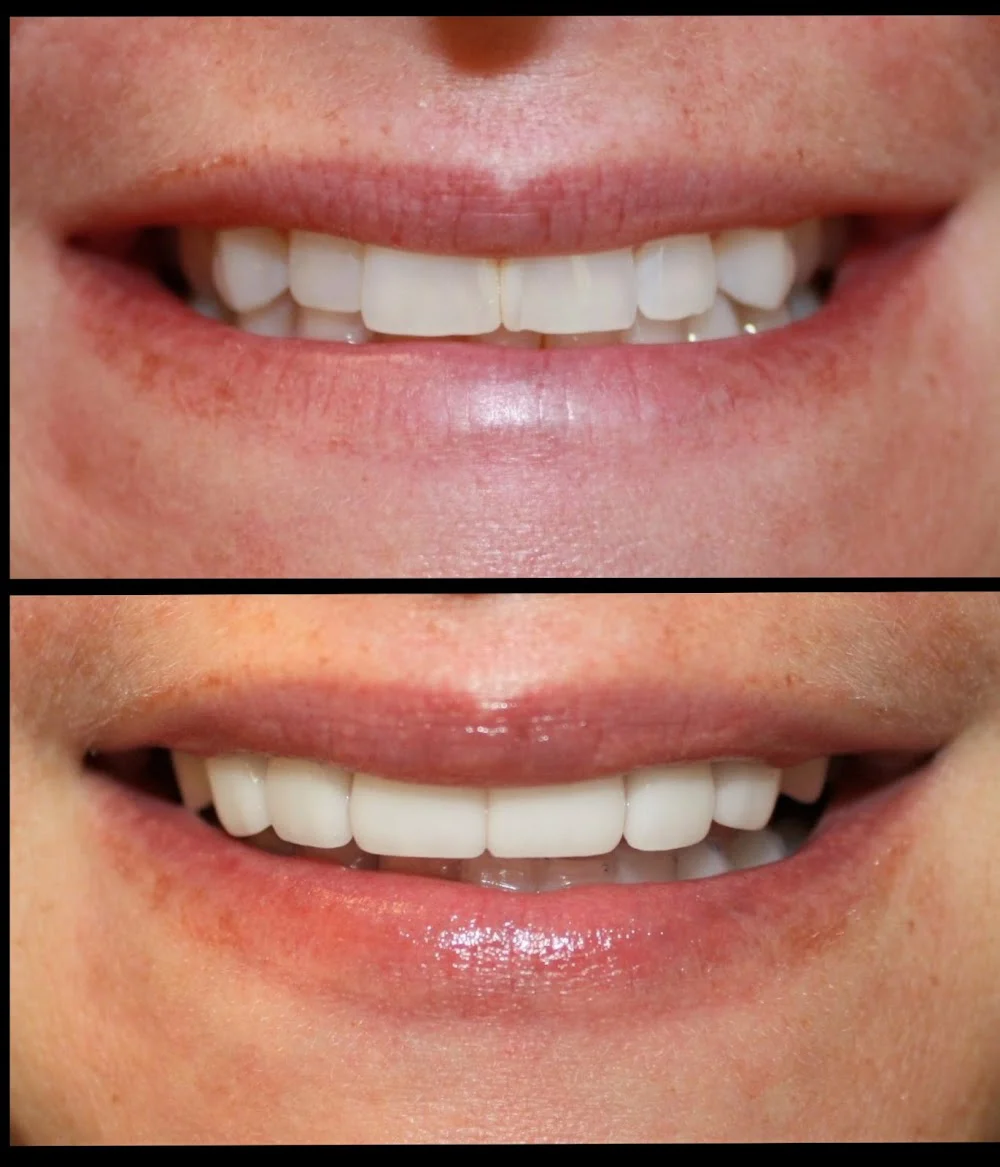 Aesthetic Dentistry at Bayfront Picture 7