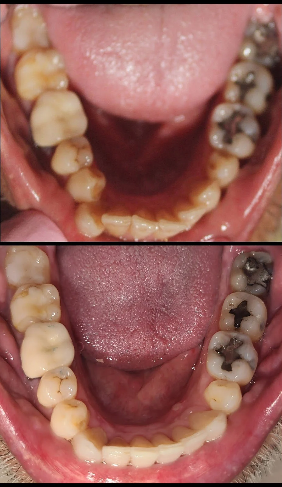 Aesthetic Dentistry at Bayfront Picture 6