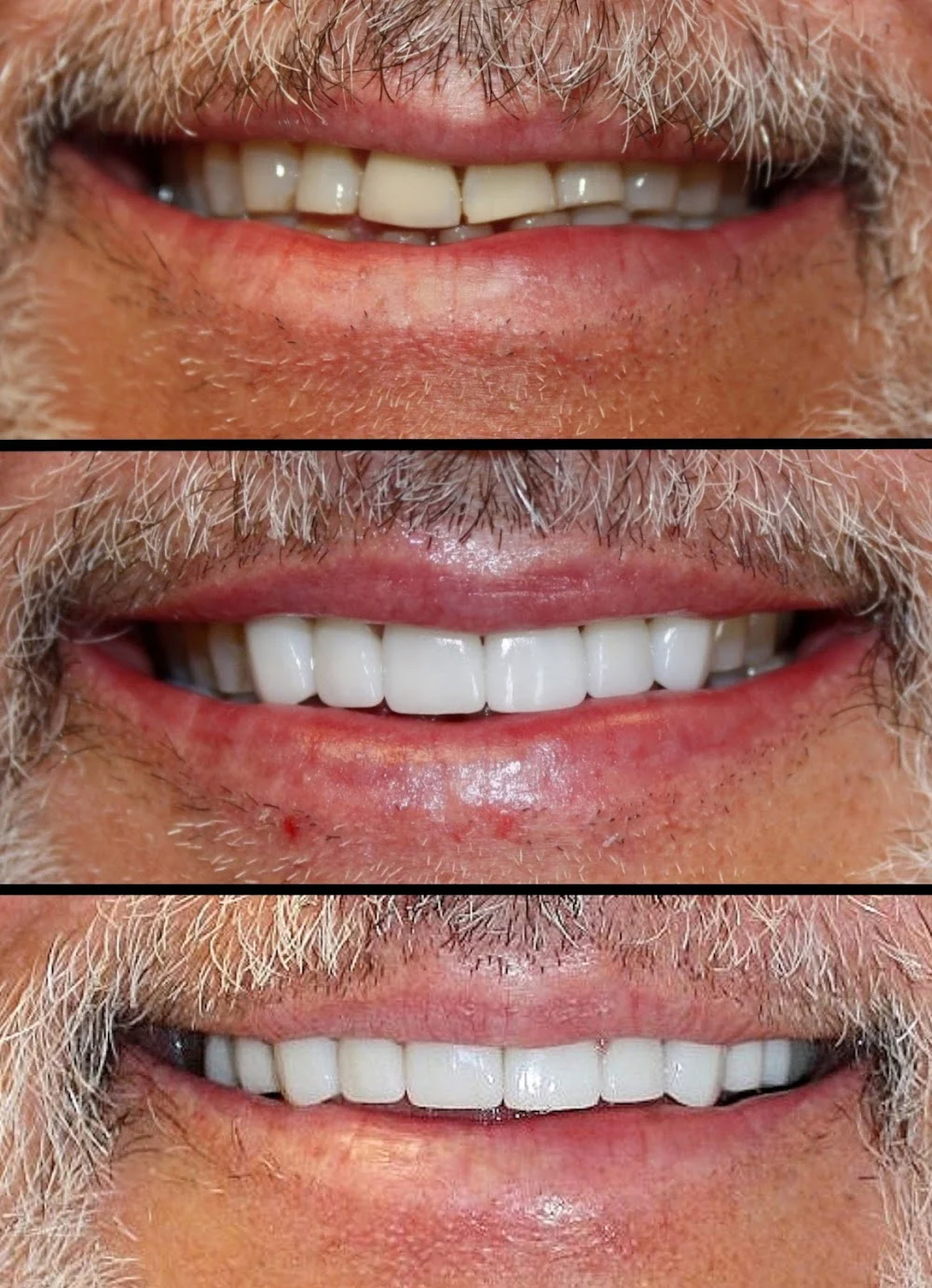 Aesthetic Dentistry at Bayfront Picture 5