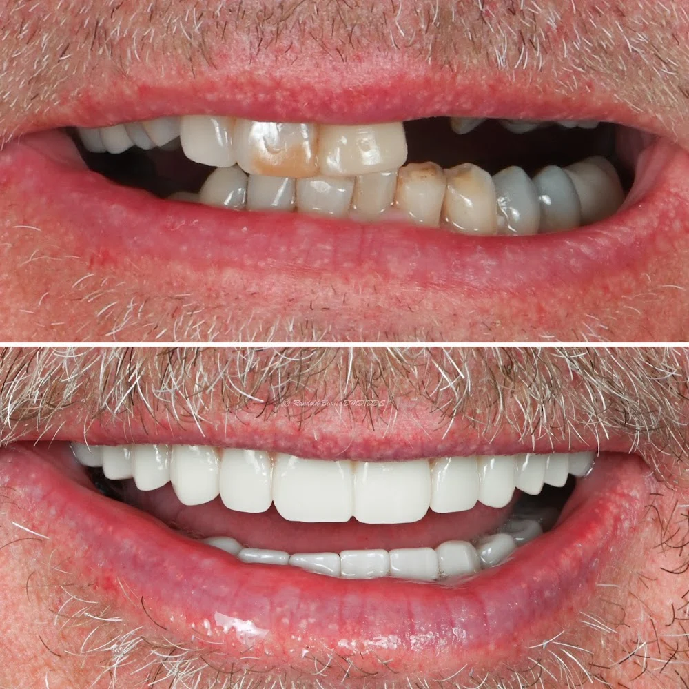 Dr. Randold Binns DMD, MS Picture 1