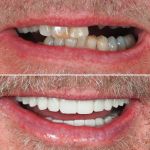 Dr. Randold Binns DMD, MS
