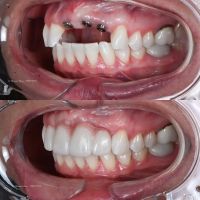 Advanced Prosthodontics & Implant Esthetics ico