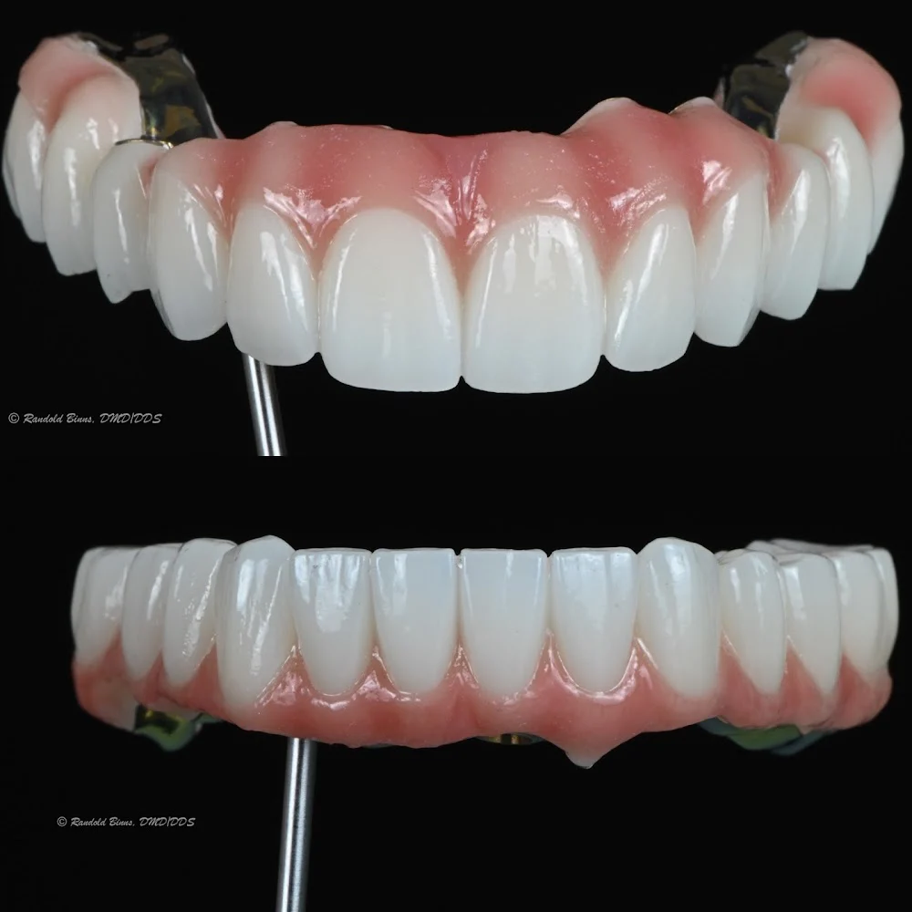 Advanced Prosthodontics & Implant Esthetics Picture 2