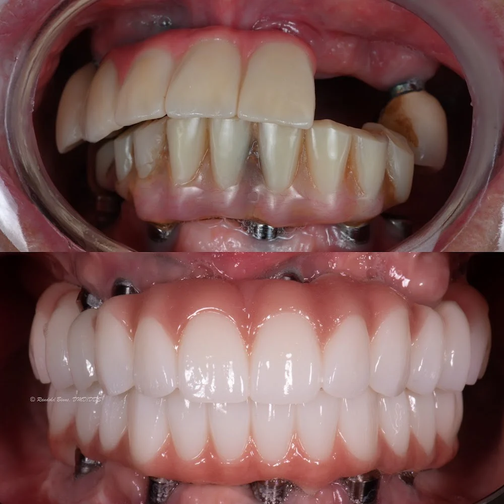 Advanced Prosthodontics & Implant Esthetics Picture 3