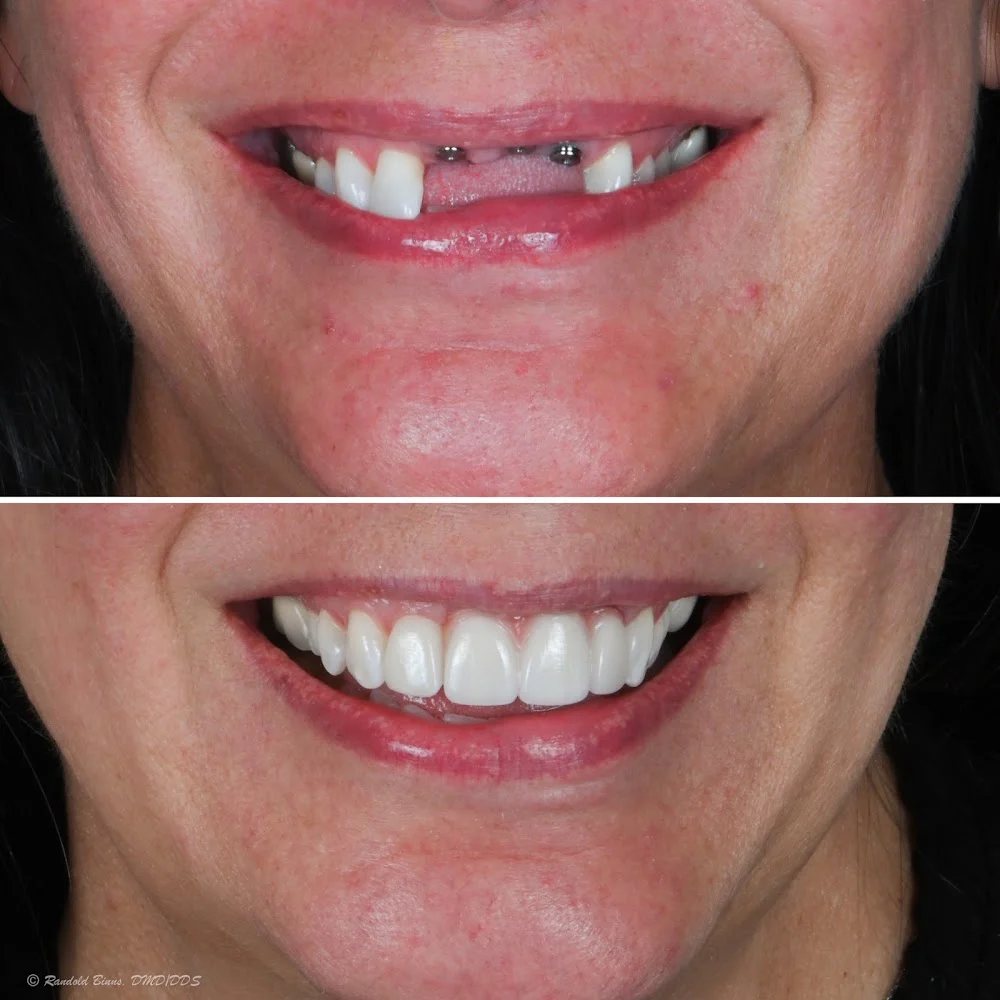 Advanced Prosthodontics & Implant Esthetics Picture 6