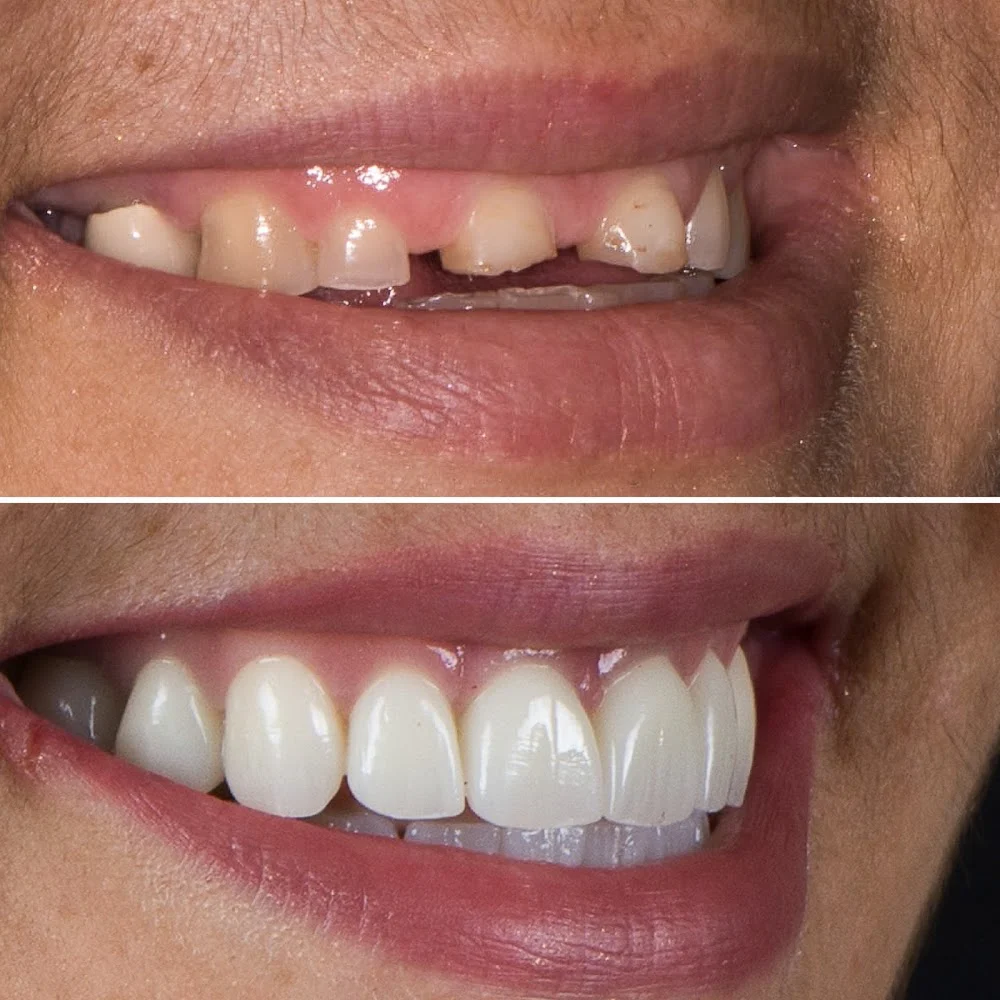 Advanced Prosthodontics & Implant Esthetics Picture 4