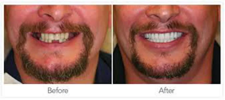 Smilecology - Thihan C. Phan DDS Picture 4