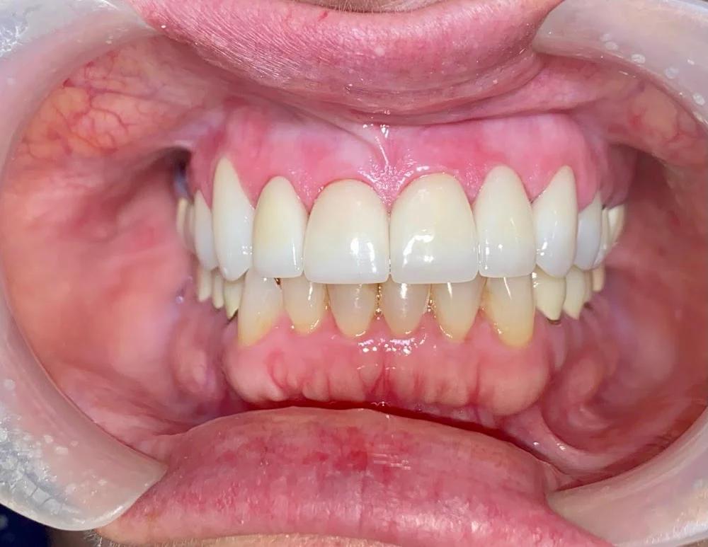 Tooth Corps Picture 7