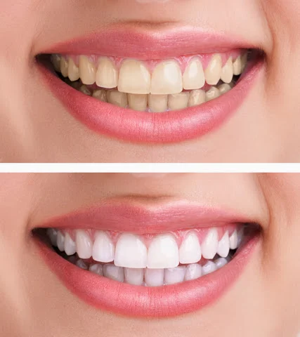 Ideal Dentistry Picture 1