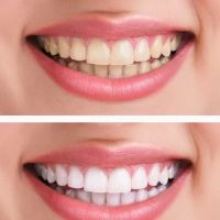 Ideal Dentistry ico