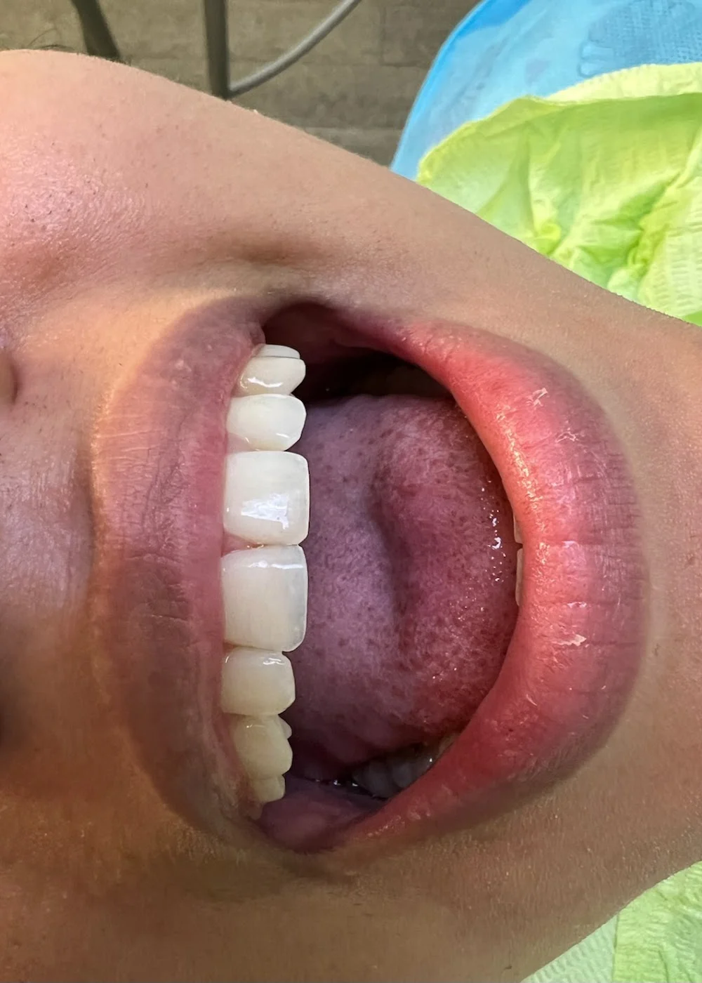 Palo Alto Advanced Dentists Picture 6