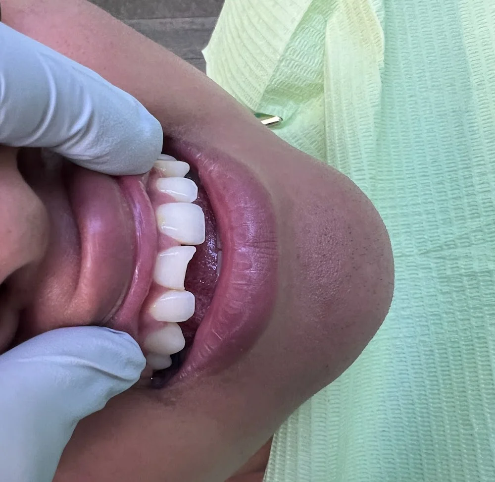 Palo Alto Advanced Dentists Picture 4