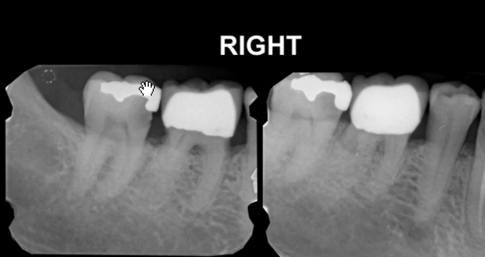 Dr. John L. Burch, DDS Picture 2