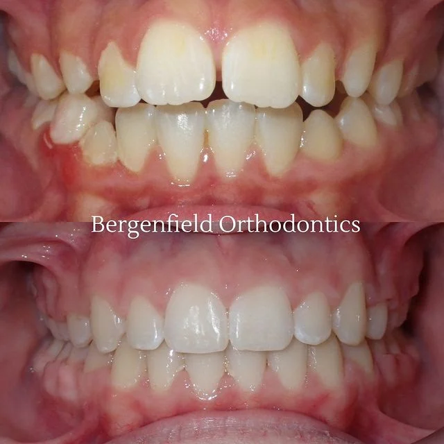 Bergenfield Orthodontics Picture 10