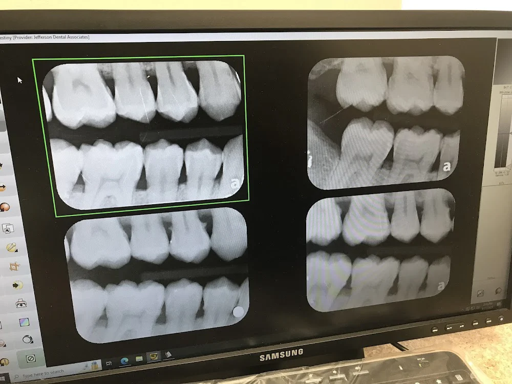 Elite Dental - Allegheny Picture 1