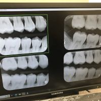 Elite Dental - Allegheny ico