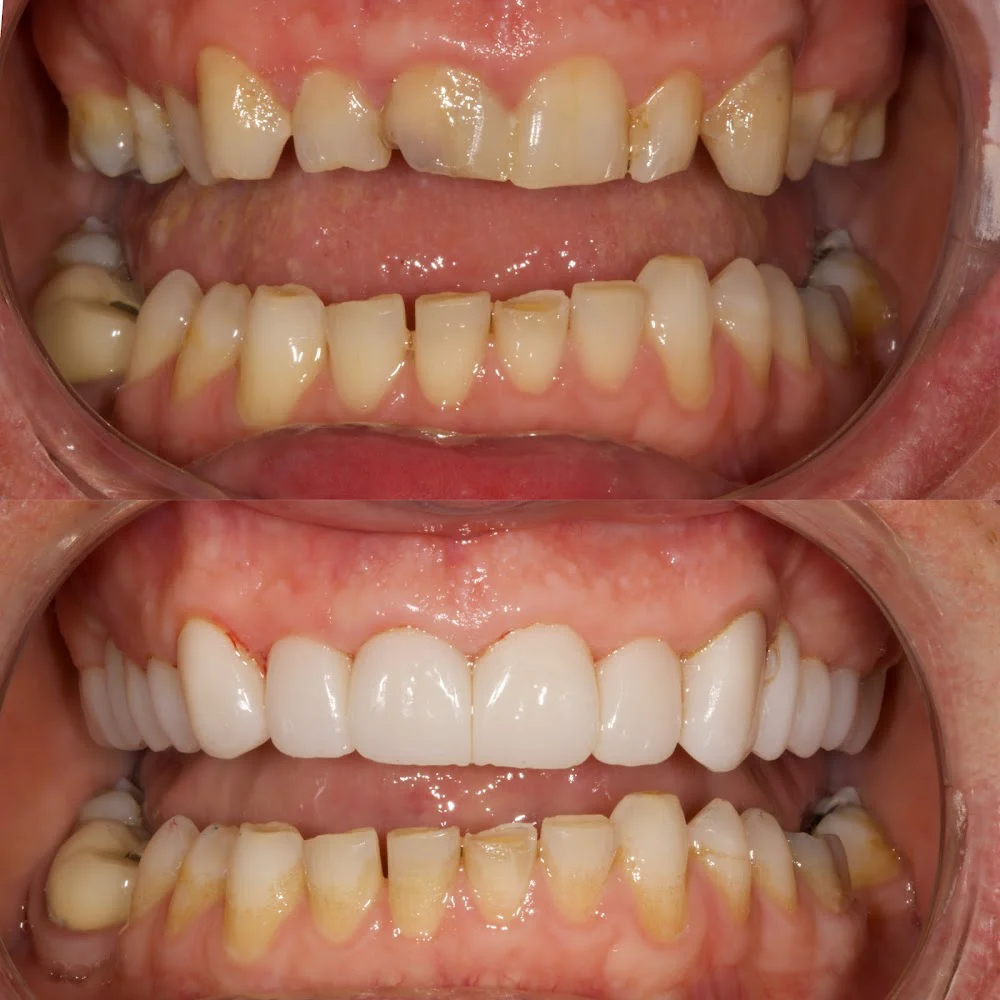 Whitemarsh Family Dentistry Picture 6