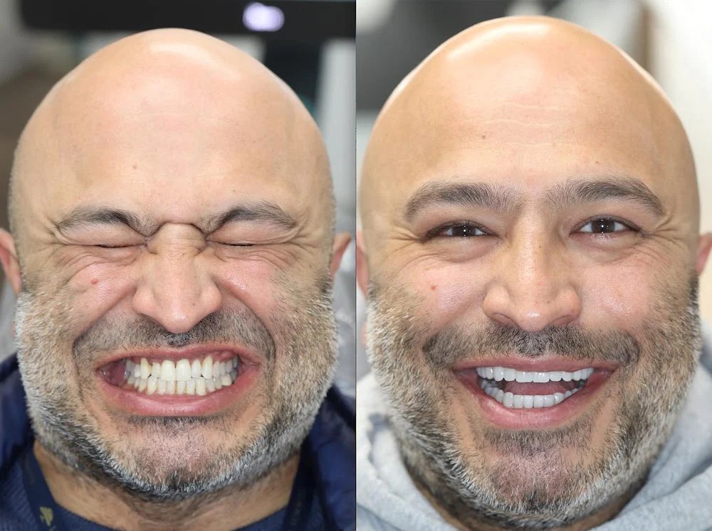 I.Dentical - All About Your Smile Picture 4