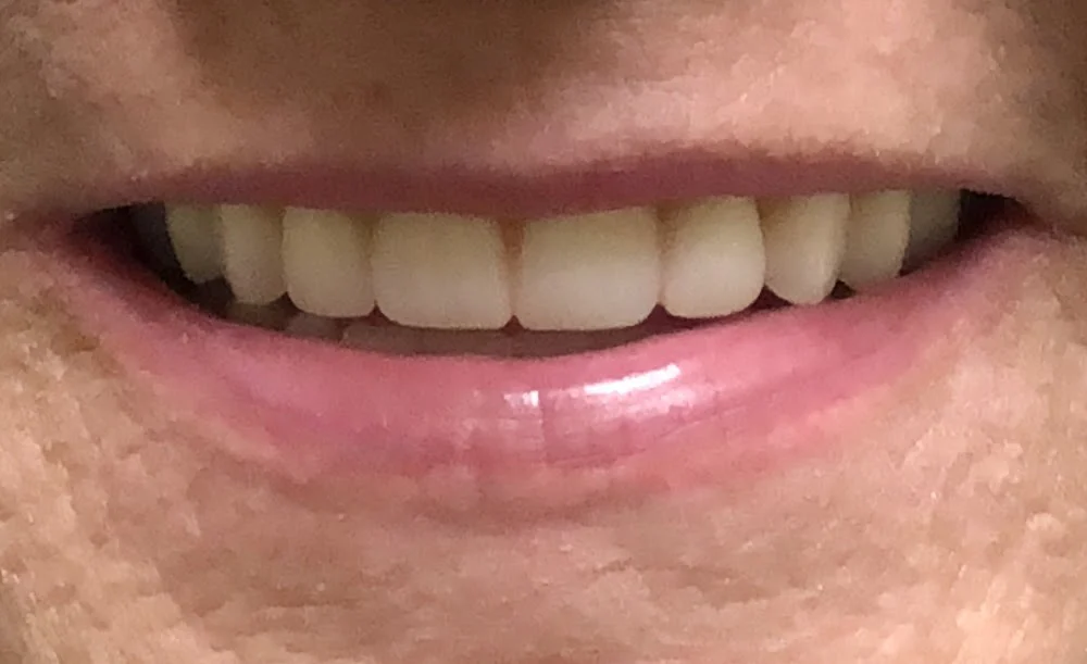 Affordable Dentures & Implants Picture 9
